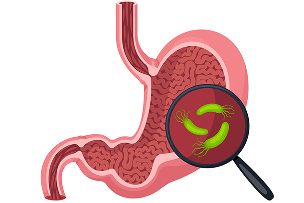 illustration of stomach with black magnifying glass zooming in on green microorganisms.