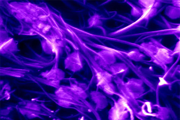 Microscopic image of blue and purple swirls on a black background.