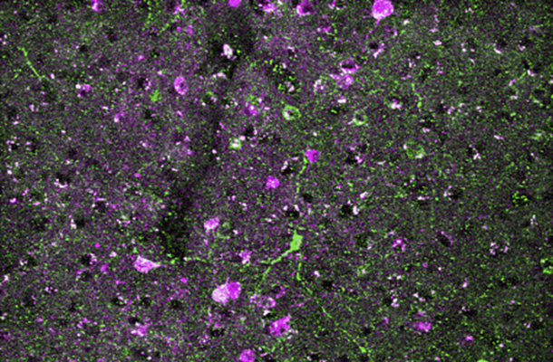 spots of pink and green show two different types of neurons