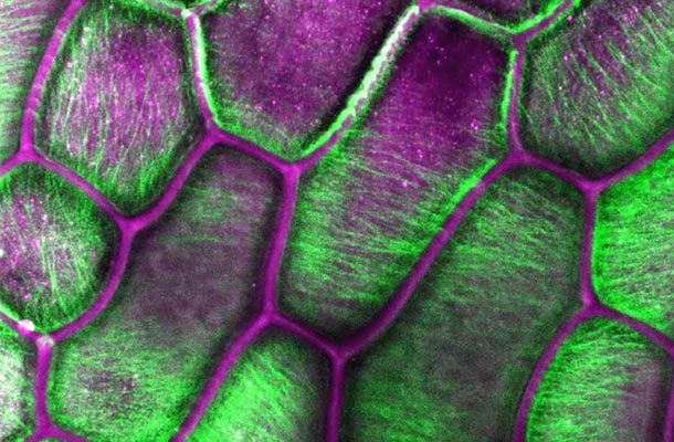 microscopic view of onion peel cells dyed purple and green