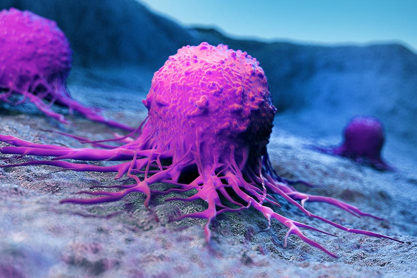 3-d rendered medically accurate illustration of a cancer cell