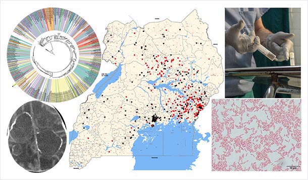 a collage showing a of uganda, dna test results, brain imaging and a lab