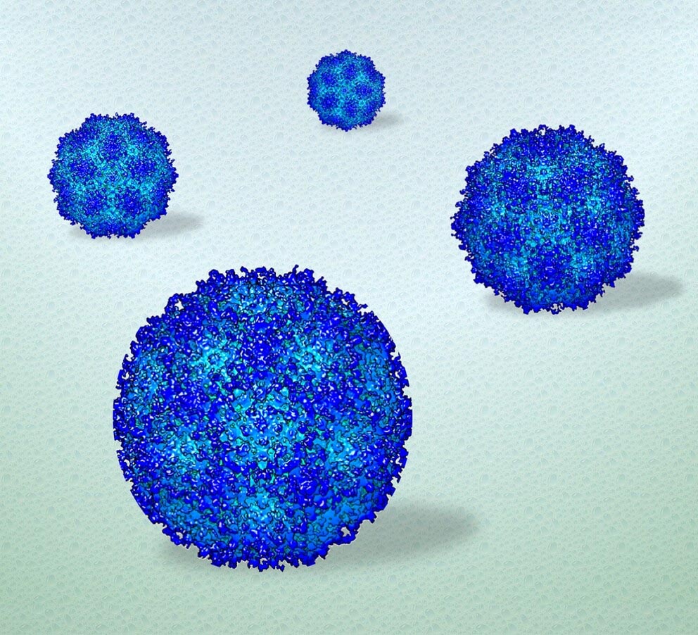 Blue textured spheres sit on a light green background