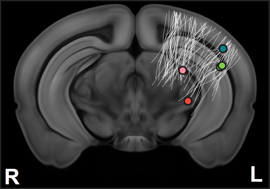 An x-ray of a mouse brain, with diagonal lines in the upper left labeled, as well as pink, green, and blue dots and the letters R and L indicating right and left sides of brain