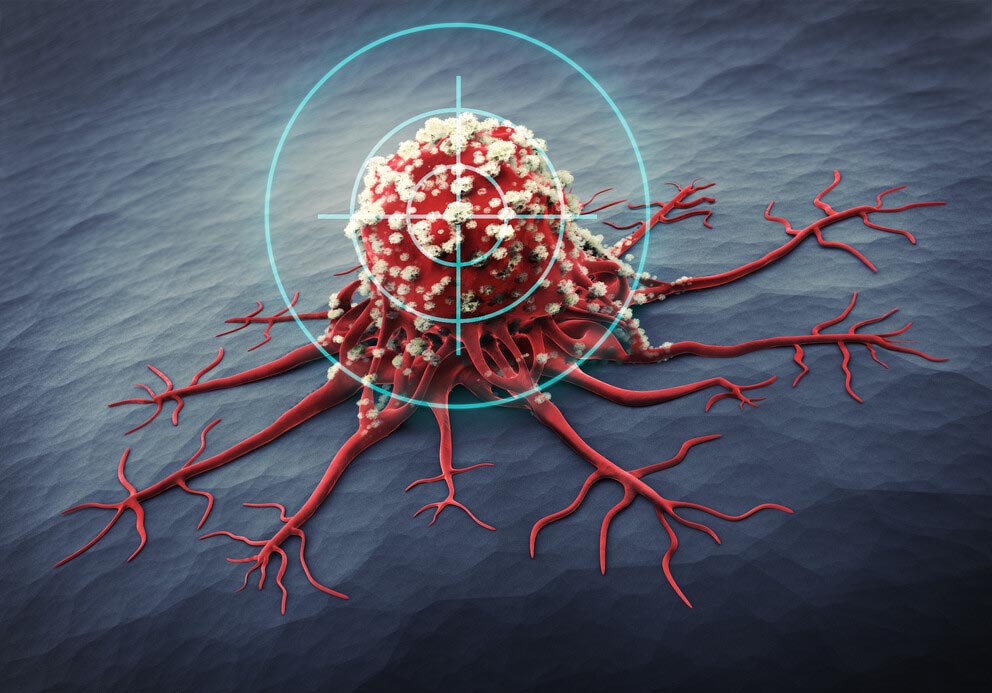 An illustration of a red cancer cell on a gray-blue background being targeted by blue crosshairs