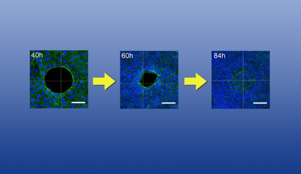 three images of a wound healing at the molecular level.