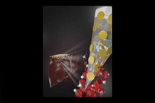Graphic of microneedle patch repairing bleeding liver
