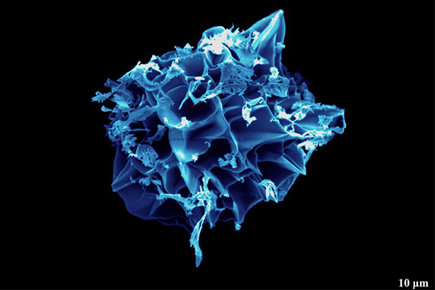 image of blue cryo microparticle