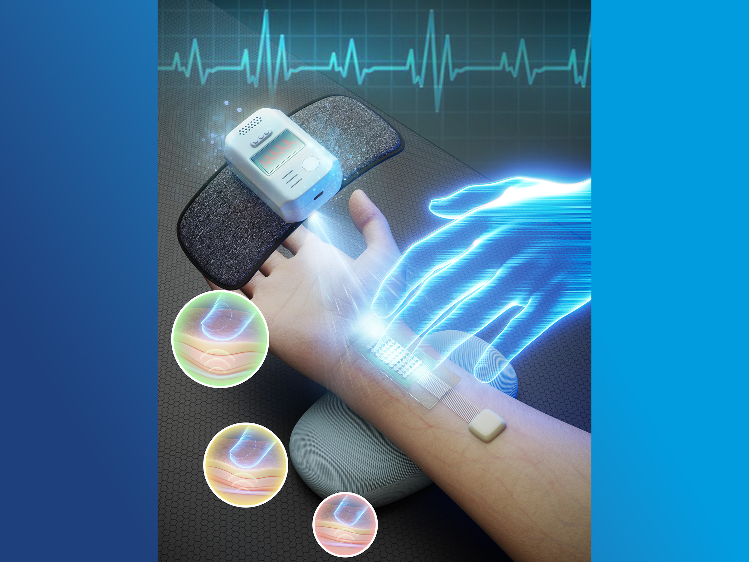 A depiction of an arm and sensor demonstrating a pressure-sensing platform to monitor pulse.