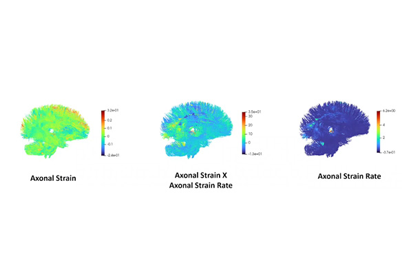 graphic of axonal strain images.