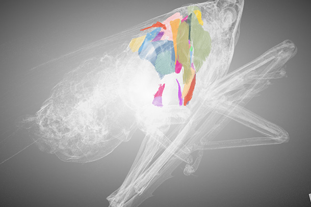 x-ray image with colors overlaid.