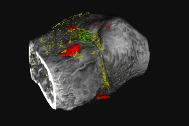 CT image with colors.