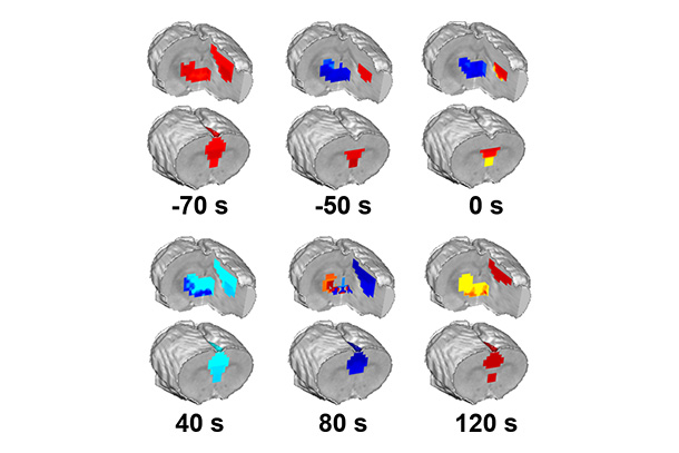 Twelve depictions of a brain 