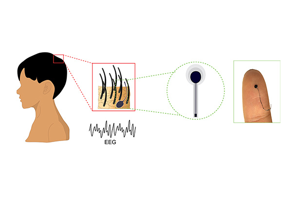 illustration of hairlike electrode for EEG monitoring